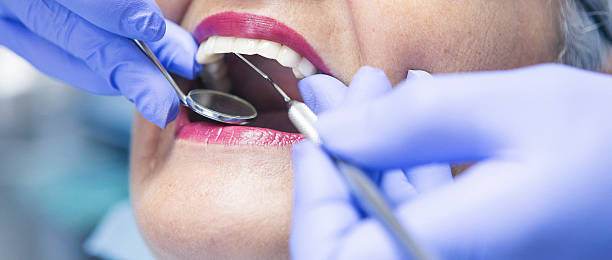 Best Broken or Chipped Tooth Repair in Royston, GA